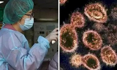 Langya Virus: ಚೀನಾದಲ್ಲಿ ಮತ್ತೊಂದು ವೈರಸ್ ಭೀತಿ: ಏನಿದು ಲಾಂಗ್ಯಾ ವೈರಸ್? ಇದರ ಲಕ್ಷಣಗಳೇನು?
