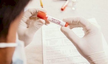 ರಾಜ್ಯದಲ್ಲಿ ಕೊರೊನಾ ಸ್ಫೋಟ : 78 ಜನರಿಗೆ ಅಂಟಿದ ಸೋಂಕು 1 ಬಲಿ