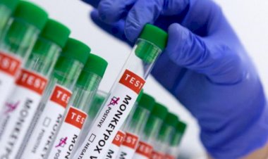 BREAKING: ಭಾರತದಲ್ಲಿ ಮೊದಲ ಶಂಕಿತ 'ಮಂಕಿಪಾಕ್ಸ್ ಪ್ರಕರಣ' ವರದಿ - ರೋಗಿಯ ಸ್ಥಿತಿ ಸ್ಥಿರ