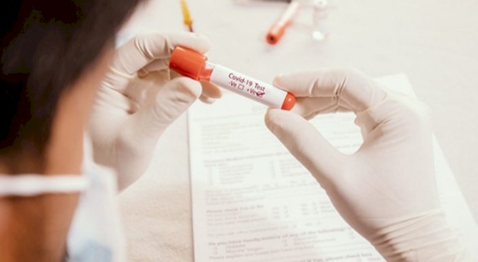 ರಾಜ್ಯದಲ್ಲಿ ಕೊರೊನಾ ಸ್ಫೋಟ : 78 ಜನರಿಗೆ ಅಂಟಿದ ಸೋಂಕು 1 ಬಲಿ