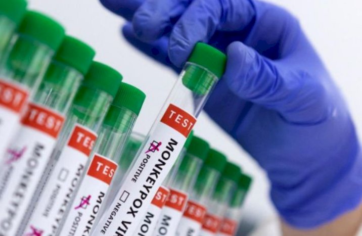 BREAKING: ಭಾರತದಲ್ಲಿ ಮೊದಲ ಶಂಕಿತ 'ಮಂಕಿಪಾಕ್ಸ್ ಪ್ರಕರಣ' ವರದಿ - ರೋಗಿಯ ಸ್ಥಿತಿ ಸ್ಥಿರ